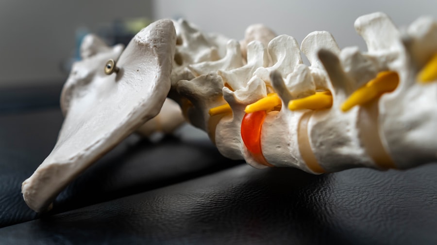 Anatomical spine model showing a highlighted spinal disc